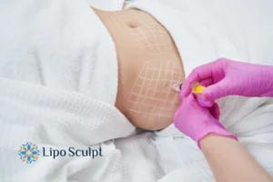 Are The Results From Aqualyx Permanent? 1 Do you want to know how long Aqualyx Stony Stratford results last?