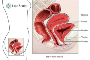 Treatment For A Leaky Bladder 2 How EM Chair treatment Stony Stratford can help Leaky bladder issues. Read more now!