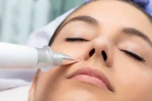 Best Actinic Keratoses Removal 3 Actinic keratoses Stony Stratford solutions - book in today!